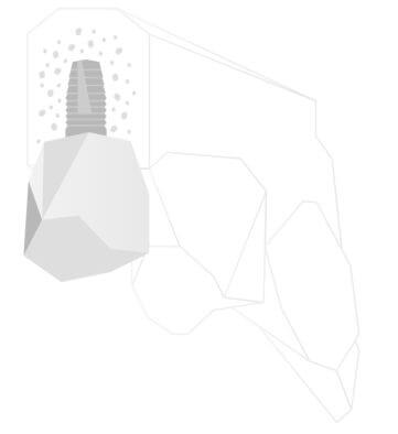 Image module